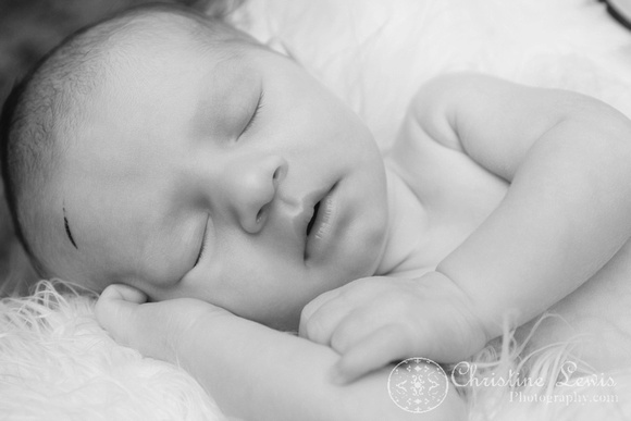 newborn photography, professional, infant, chattanooga, tennessee, tn, baby, boy, cute, &quot;black and white&quot;, scar